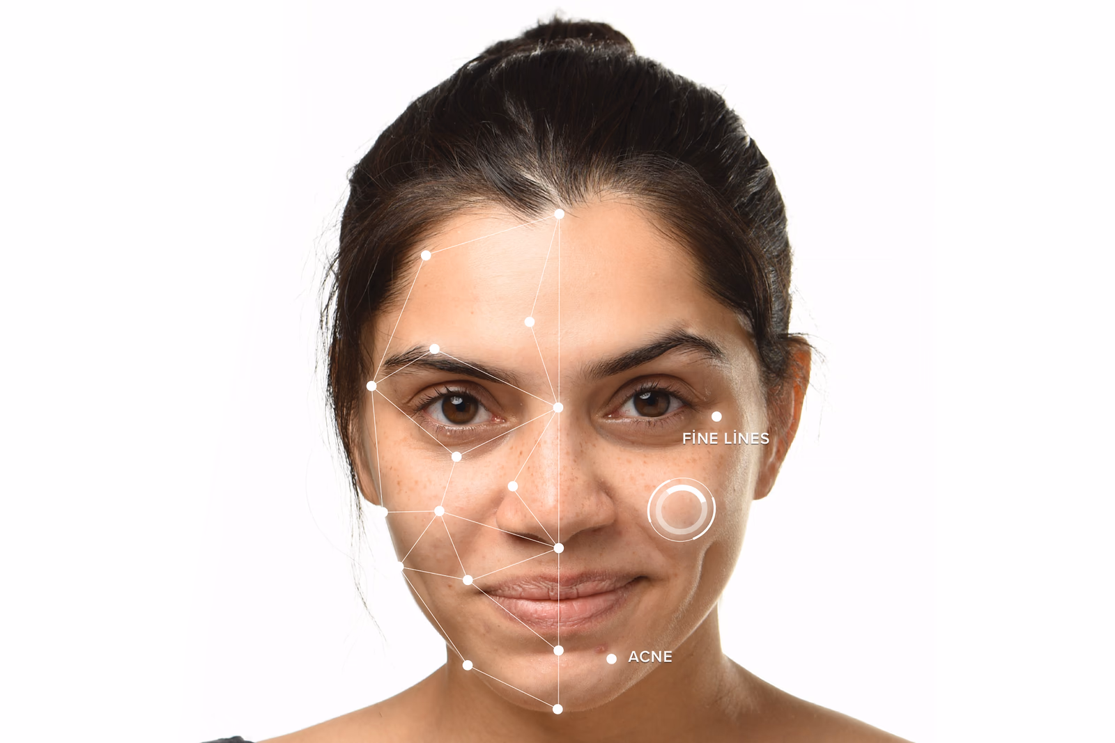 AI Skin Analysis